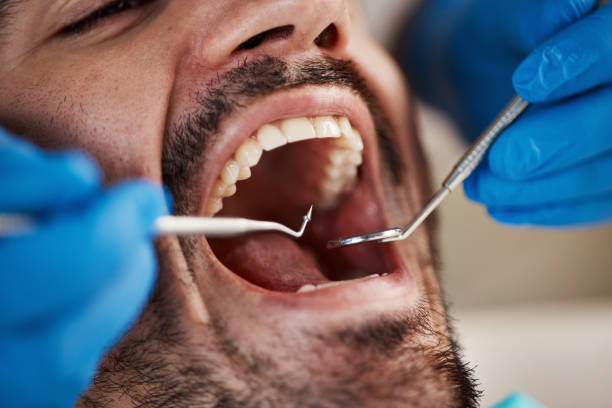 Best Emergency Orthodontic Repairs in Keystone, FL